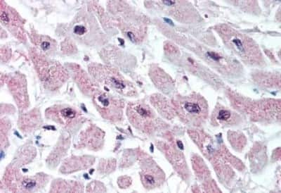 Immunohistochemistry-Paraffin: Kir3.1 Antibody [NBP3-14384]